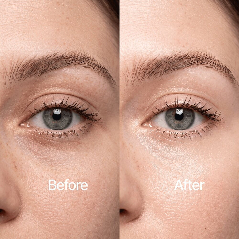 Side-by-side close-up of an eye area labeled Before and After